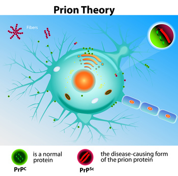 Falsch gefaltete Proteine führen zur Zerstörung der Nervenzellen
